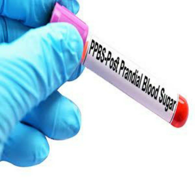 SPMC-ST000004.jpg